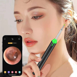 MMPANG Ear Wax Removal Endoscope