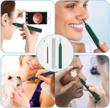 1080P FHD Wireless Earwax Removal Tool for iPhone