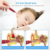 1080P FHD Wireless Earwax Removal Tool for iPhone