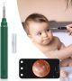  Ear Wax Removal Tool w/ Camera￼